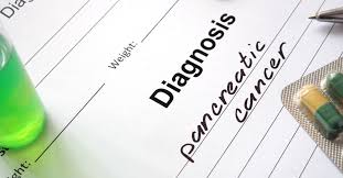 Common symptoms of pancreatic cancer the following are the most common signs of exocrine pancreatic cancer—specifically for pancreatic adenocarcinoma. How Did You Discover You Had Pancreatic Cancer Froedtert Mcw
