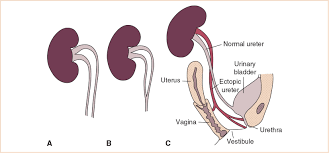 The Urogenital System Anesthesia Key