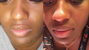 (urban skin rx is in over 4,000 doors.) since january, monthly sales have increased by 150%, and cleansing bar sales. Urban X Skin Care Reviews Nuevo Skincare
