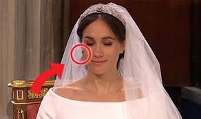 And prince edward, earl of wessex. Meghan Markle Fly On Face Unluler