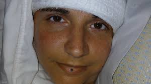 Paralyzed woman reveals shocking effect of Elon Musk's Neuralink brain chip 