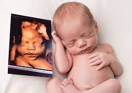 My Baby You Ll Be 4d Ultrasound