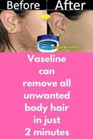 Vaseline Can Remove All Unwanted Body Hair In Just 2 Minutes Today I Will Tell You How Can You Use Vaseline To Unwanted Hair Removal Unwanted Hair Hair Health