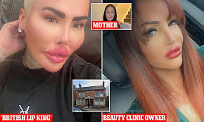 Revealed: Mother, 33, who died after non-surgical BBL was treated at UK  beauty clinic run by TV star dubbed the 'Lip King'