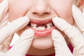 inovadent ortodonti cocuklarda sut dislerine kanal tedavisi