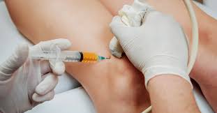 PRP and Regenerative Treatments