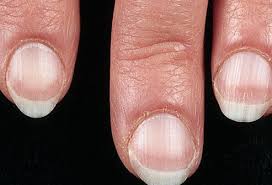 nail disorders what nails say about