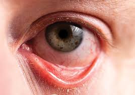 Image result for Blepharis transvaalensis