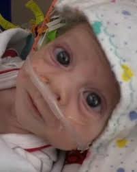 ✨Where Hope Soars 💫 🎣 Elijah “Eli” Mayes, an 11-year-old from Lewisburg,  Kentucky, is thriving despite battling hypoplastic left heart syndrome, a  rare and complicated heart disease.❤️ Read more about Eli's journey