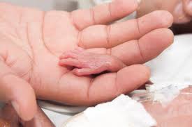 Optimal vitamin d levels in breastfed infants can be maintained with supplementation of 400 iu/day of vitamin d. High Dose Supplementation Cuts Vitamin D Deficiency In Severely Premature Babies