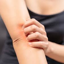 Healing Eczema Psoriasis Amp Amp Acne By Medical Medium On Soundcloud Medical Medium Psoriasis Medical Medium Anthony William