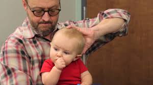 Treatment For Plagiocephaly Youtube