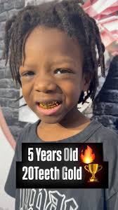 Listen to the audio You can hear the lack of common sense in his mothers  laugh and words “LOW IQ” the kid is just participating because his mom  asked him to but