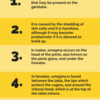 Thanks (original post by anonymous) for the past year i have been washing my member regularly but i cannot seem to get rid of smegma build up? How To Get Rid Of Smegma For Men And Women