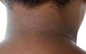 Check spelling or type a new query. 5 Strange Symptoms That Could Be Early Signs Of Diabetes Geelong Medical Health Group