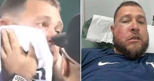 Pítcher cubano Lázaro Blanco necesitará cirugía tras recibir pelotazo en el  rostro