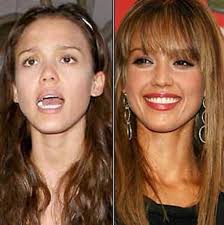 Jessica Alba Estetiksiz Hali