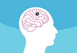 Talk only when the reception signal is strong. Why A Brain Tumor Does Not Always Mean You Have Cancer Health Essentials From Cleveland Clinic