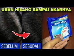 Uban Hilang Sampai Ke Akarnya Cukup 5 Menit Cara Menghilangkan Uban Dala Sekejap Youtube Obat Alami Kesehatan Alami Kesehatan