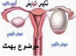 اسباب تكيس المبايض عند البنات الغير متزوجات موضوع يهمك Url Redirection Facebook 2 Text