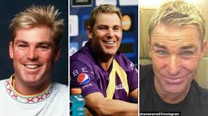 Cricket legend Warne has 'dabbled' in cosmetic surgery