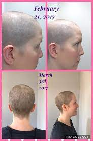 2 Months Post Chemotherapy She Has Been Using Irt Spray Twice A Day S3 The Irt Shampoo And Rejuveniqe Oil Her Hair Is Coming In Monat Chemotherapy Her Hair