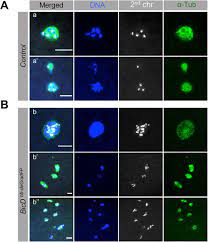 Whenever students face academic hardships, they tend to run to online essay help companies. Novel Roles For Bicd In Pronuclear Fusion And Meiosis Ii Progression Via Localization Of The Chc Tacc Msps Complex To Mii Spindles Biorxiv