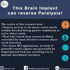 In addition, intracranial recordings of the stn area revealed increased. Biocom Neural Brain Implant Is A Device When Inserted Facebook