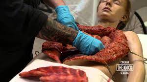 The Knick Season 2: Body Shop Heroin Addict Autopsy (Cinemax) - YouTube