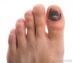 Check spelling or type a new query. What Are The Most Common Causes Of Big Toe Pain