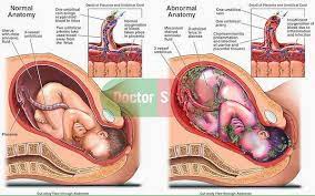 Tapi sekarang aku kuliah di jakarta di salah satu kampus yang tidak begitu terkenal di jakarta. Apakah Nama Cecair Yang Fetus Berada Dalamny Aretu
