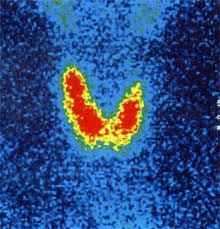 Die sonographie ist das wichtigste bildgebende instrument der schilddrüsendiagnostik. Schilddrusen Zentrum Koln Holweide