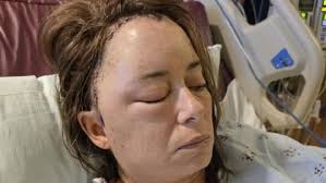 Fundraiser by Amanda Dutcher : Support Gwen's Recovery from Brain Bleed