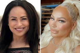 Does Stacey Silva Have Vitiligo? What Happened To Skin | In Touch Weekly