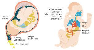Schwanger Test Auf B Streptokokken Sinnvoll Baby Und Familie