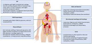 Malignant pleural mesothelioma (mpm) is a highly lethal cancer of the lining of the chest cavity. Cells Free Full Text Liquid Biopsy Of Non Plasma Body Fluids In Non Small Cell Lung Cancer Look Closer To The Tumor Html