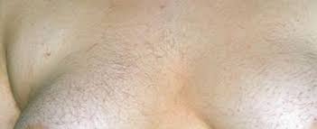 To make this, mix one part of vinegar and an equal part of water to prepare the soak solution. Doctor Is It Necessary To Have Some Hair On The Breasts Gbetu Tv
