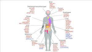 Colorectal cancer might not cause symptoms right away, but if it does, it may cause one or more of these symptoms: Some Lncrnas Associated With Cancers The Colour Represents Either Download Scientific Diagram