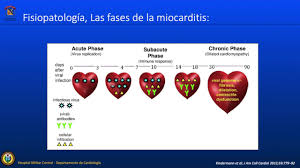 Viral presence guided immunomodulation in lymphocytic myocarditis: Otras Formas De Miocarditis Aguda Mas Alla De Las Causas Virales Youtube