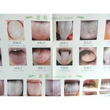 chart of tongue diagnosis in tcm code h14 sino ro