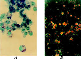 Image result for Rickettsiae