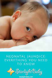 Complications may include seizures, cerebral palsy, or kernicterus. Neonatal Jaundice Everything You Need To Know Kinacle