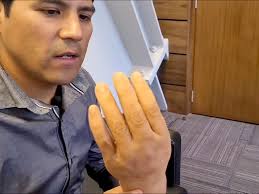 Dimos un paso significativo hacia el futuro de nuestra juventud con la  aprobación del Proyecto de Ley de Apoyo a los Emprendimientos Emergentes en  la Comisión de Política Social del Senado. Me ...