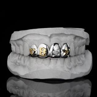 Custom grillz from a Tokyo jewelry shop, AI generated