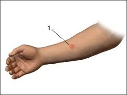 A tuberculosis (tb) screening is used to find out if you've been infected with tb, a serious disease affecting the lungs. Pin Op Abbreviations For Medical Purposes