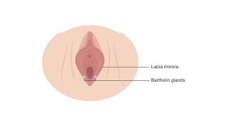 Image result for Bartholin's gland abscess