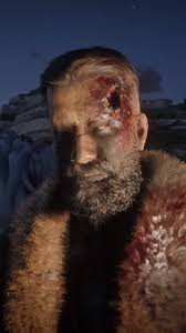 Survived A Headshot In Red Dead 2 Album On Imgur One of the best handguns in the game (incredible headshot results with this) is a reward for you for. survived a headshot in red dead 2