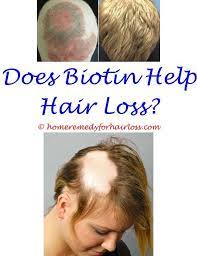 We are on day 2 and the side effects are already awful.we are excited to see what happens! Hair Loss Forum Big 3 Medical Term For Hair Loss Or Baldness How To Treat Loss Of Hair In Cats How To Cover Loss Hair Loss Cure Hair Loss Men