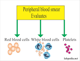 Red Blood Cell Rbc Part 1 Morphology Peripheral Blood