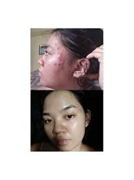 Beauty Set Application Procedure step-by-step procedure so you can  #GlowWithConfidence Night time: 1. Clean face, neck and arms with skin  toner using facial cotton. 2. Wash face with Beauché kojic soap.pat dry